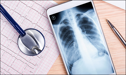 Fraud Class Action Filed Against Health Technology Company Greenway Health by Lieff Cabraser