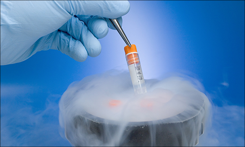 Pacific Fertility Clinic Lost Egg and Embryo Class Actions